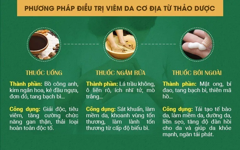 Bệnh viêm da cơ địa: Dấu hiệu và cách chữa từ tinh hoa y học cổ truyền - Ảnh 2.