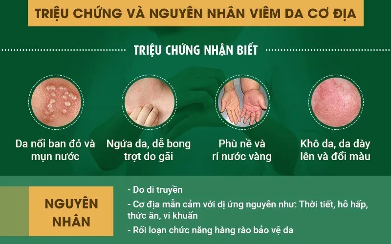 Bệnh viêm da cơ địa: Dấu hiệu và cách chữa từ tinh hoa y học cổ truyền - Ảnh 1.