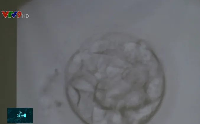 C&ocirc;ng nghệ mới gi&uacute;p cha mẹ nh&igrave;n thấy con khi c&ograve;n l&agrave; ph&ocirc;i thai - Ảnh 2.