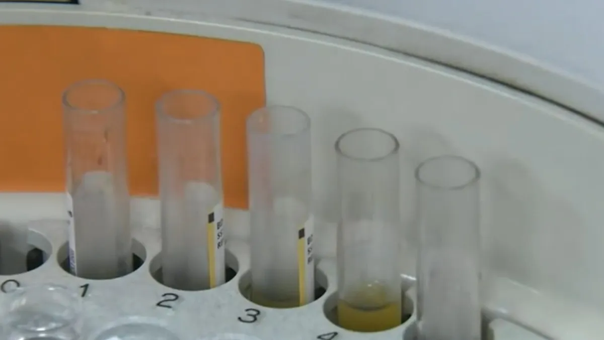 Nhật Bản nhập khẩu virus nguy hiểm để nghiên cứu phòng bệnh - Ảnh 1. Nhật Bản nhập khẩu virus nguy hiểm để nghiên cứu phòng bệnh - Ảnh 1.