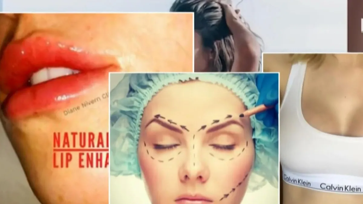 Phẫu thuật thẩm mỹ hốt bạc nhờ COVID-19 - Ảnh 1.