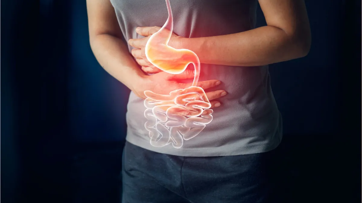 Cảnh báo lạm dụng kháng sinh trong đẩy lùi bệnh viêm loét đại tràng - Ảnh 1.
