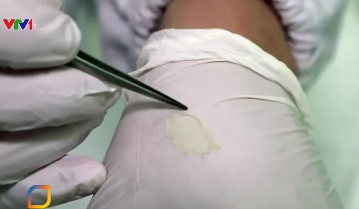 Tạo ra da người trong ph&ograve;ng th&iacute; nghiệm - Ảnh 1.