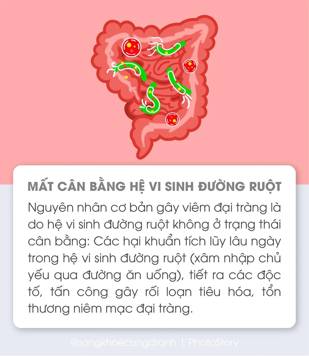 5 nguyên nhân phổ biến gây viêm đại tràng - Ảnh 1. 5 nguyên nhân phổ biến gây viêm đại tràng - Ảnh 1.