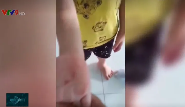 Làm rõ thông tin giáo viên mầm non dùng vật nhọn đâm vào bàn tay bé trai 5 tuổi - Ảnh 1. Làm rõ thông tin giáo viên mầm non dùng vật nhọn đâm vào bàn tay bé trai 5 tuổi - Ảnh 1.