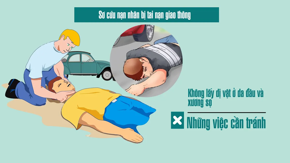 Sơ cứu nạn nhân bị tai nạn giao thông thế nào cho đúng? - Ảnh 6.