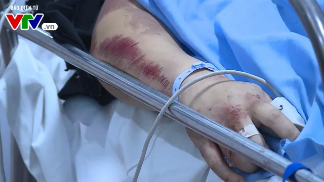 Số ca cấp cứu tai nạn giao thông do bia rượu dịp nghỉ lễ vẫn gia tăng - Ảnh 5. Số ca cấp cứu tai nạn giao thông do bia rượu dịp nghỉ lễ vẫn gia tăng - Ảnh 5.