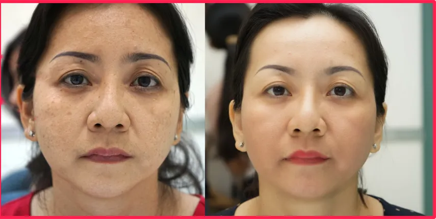 5 l&yacute; do n&ecirc;n chọn kem chống l&atilde;o h&oacute;a 22Again - Ảnh 9.