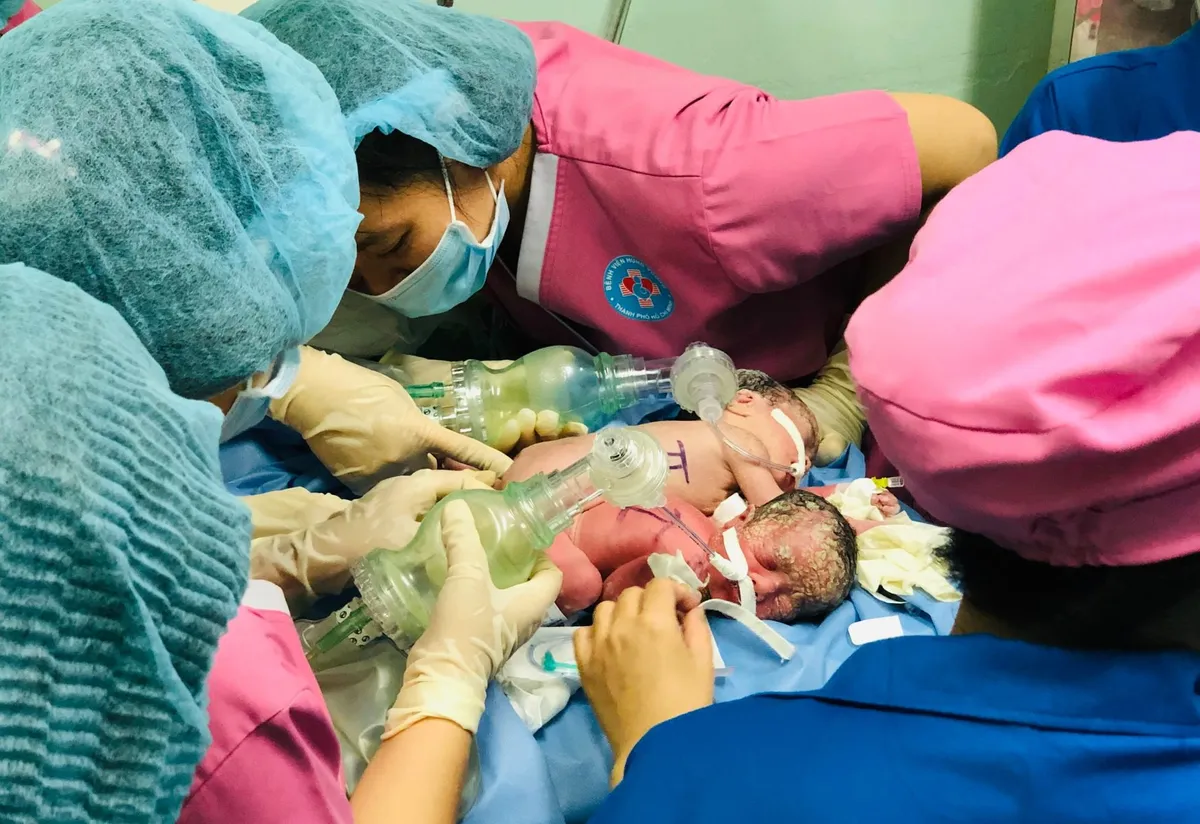 Mổ thành công hai bé gái song thai dính liền hậu môn - Ảnh 2. Mổ thành công hai bé gái song thai dính liền hậu môn - Ảnh 2.
