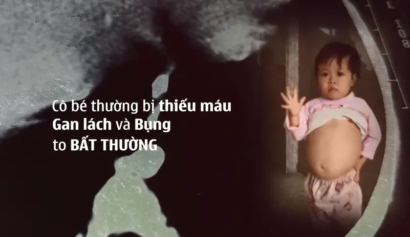 Những đứa trẻ hạnh phúc: Nụ cười của cô bé mắc bệnh hiếm Gaucher - Ảnh 1.
