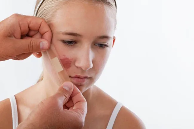 7 c&ocirc;ng dụng tuyệt vời để chăm s&oacute;c da từ quả lựu - Ảnh 7.