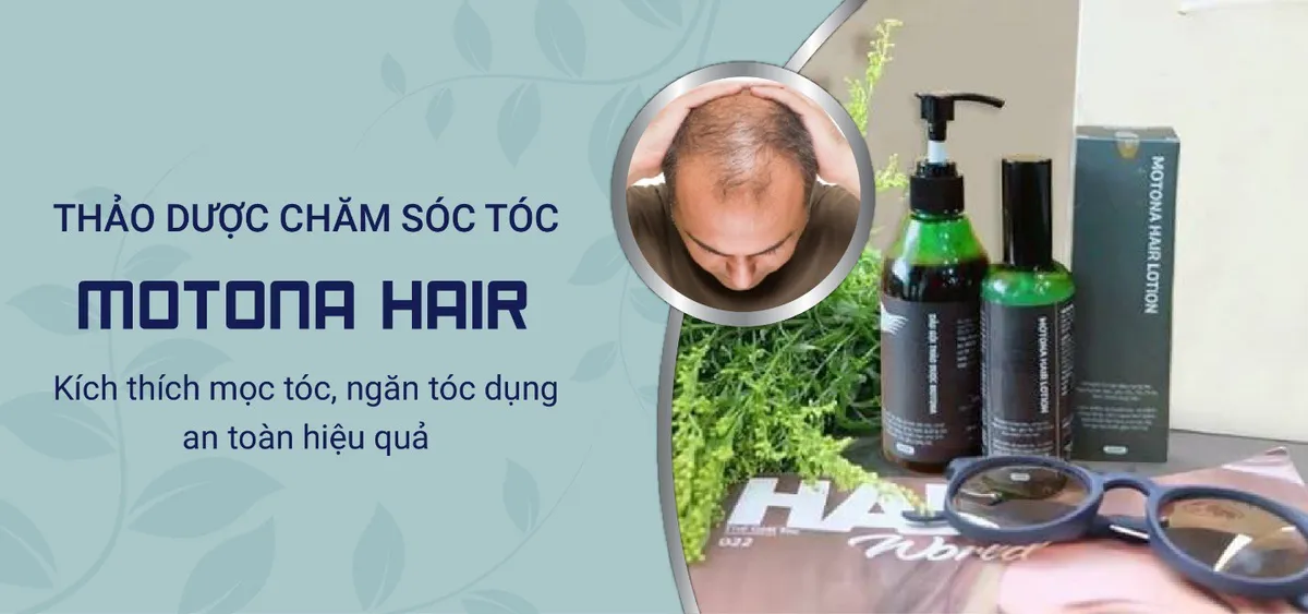 5 lý do nên chọn dầu gội thảo dược Motona Hair - Ảnh 2.