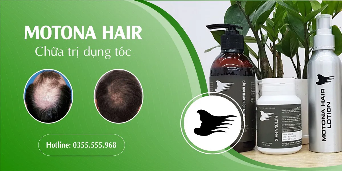 5 lý do nên chọn dầu gội thảo dược Motona Hair - Ảnh 4.