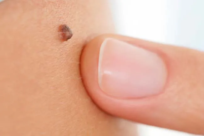 Mách bạn một số bài kiểm tra sức khỏe đơn giản tại nhà - Ảnh 7.