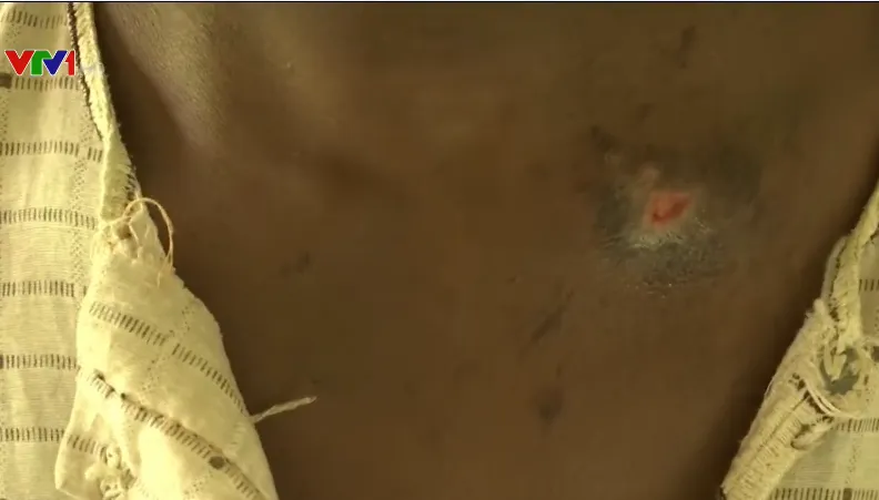 400 người bị tra tấn trong một căn nh&agrave; ở Nigeria - Ảnh 2.