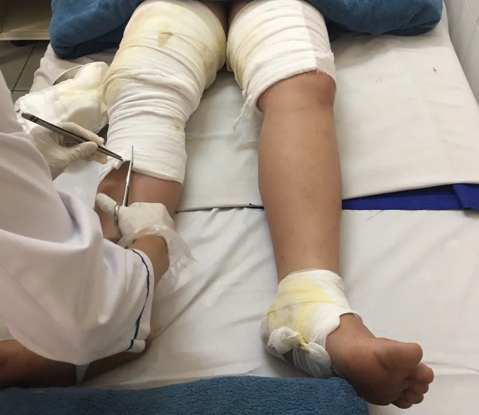 Sau tiếng nổ, người mẹ tá hỏa thấy con trai bị bốc cháy - Ảnh 1. Sau tiếng nổ, người mẹ tá hỏa thấy con trai bị bốc cháy - Ảnh 1.