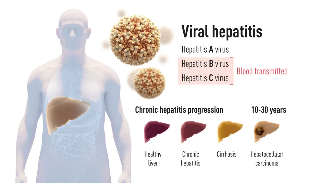 Tầm quan trọng của nghiên cứu về virus Viêm gan C được vinh danh tại giải Nobel Y học 2020 - Ảnh 2.