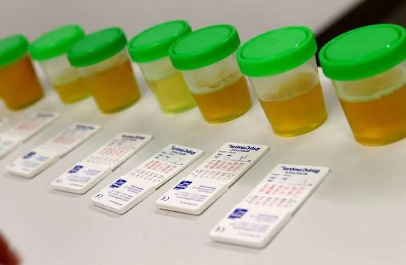 Nguy cơ gian lận ở các mẫu thử doping tại giải Ngoại hạng Anh - Ảnh 1. Nguy cơ gian lận ở các mẫu thử doping tại giải Ngoại hạng Anh - Ảnh 1.