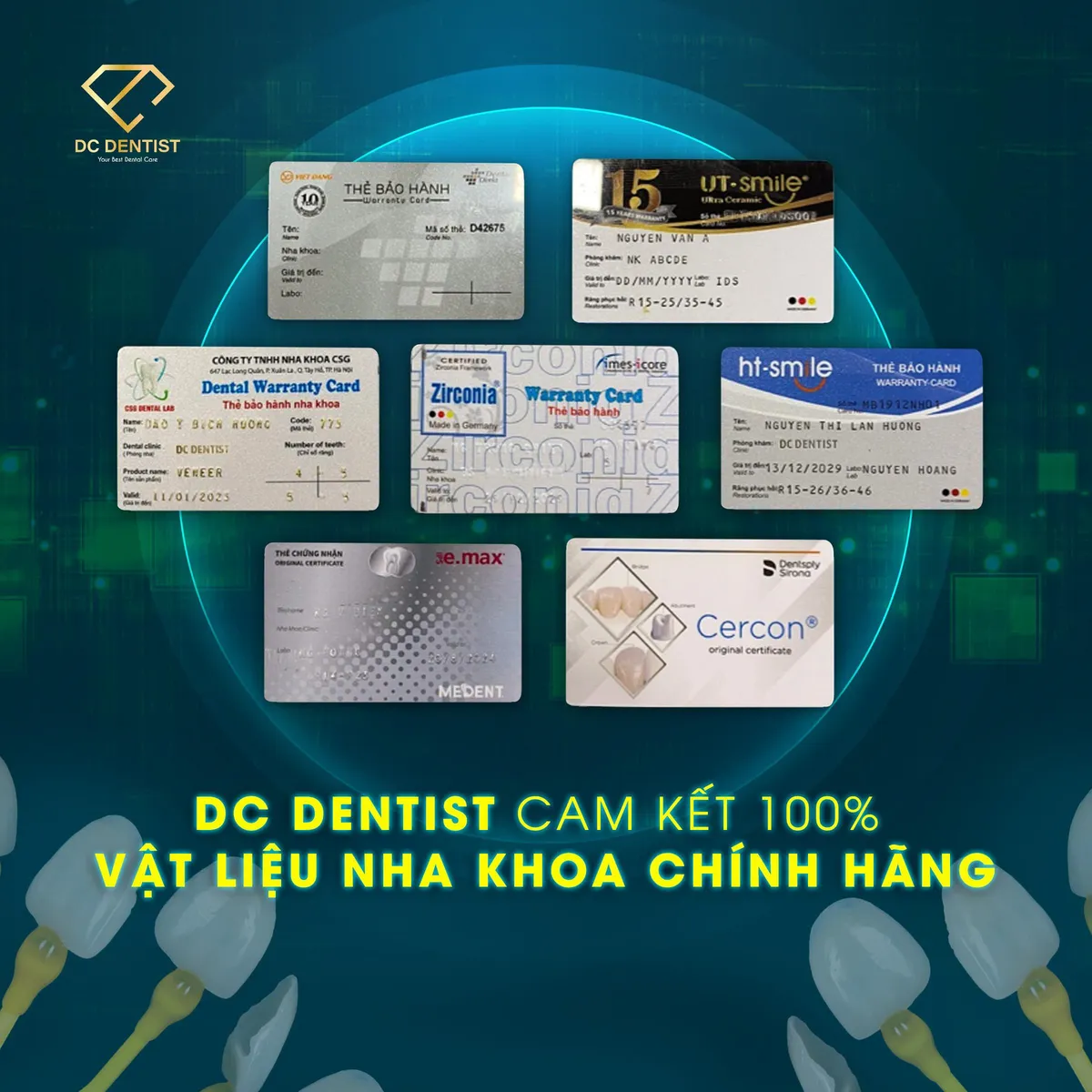 Hành trình tìm lại nụ cười tự tin bằng phương pháp phục hình Implant và bọc sứ Emax - Ảnh 6.