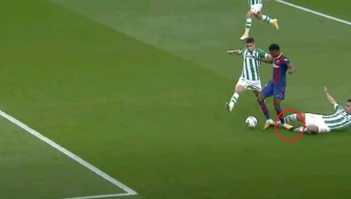 Ansu Fati phải nghỉ 3-5 tháng, Barcelona lo lắng - Ảnh 1.