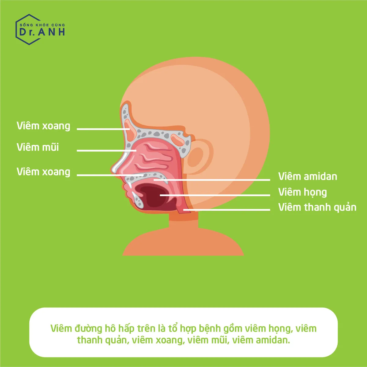 Hiểu đúng về viêm đường hô hấp trên của trẻ để xử lý đúng cách - Ảnh 3.