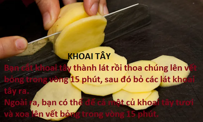 10 mẹo chữa bỏng tại nhà hiệu quả - Ảnh 3.