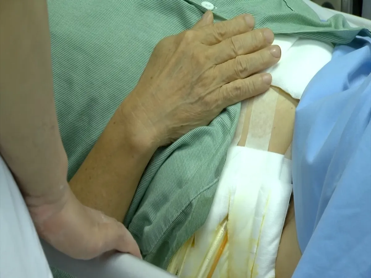 Nuốt tăm thủng ruột, cảnh báo thói quen ngậm tăm của người già - Ảnh 2. Nuốt tăm thủng ruột, cảnh báo thói quen ngậm tăm của người già - Ảnh 2.