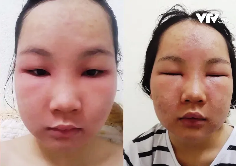 Rước họa v&agrave;o th&acirc;n v&igrave; kem trộn gi&aacute; b&egrave;o - Ảnh 1.