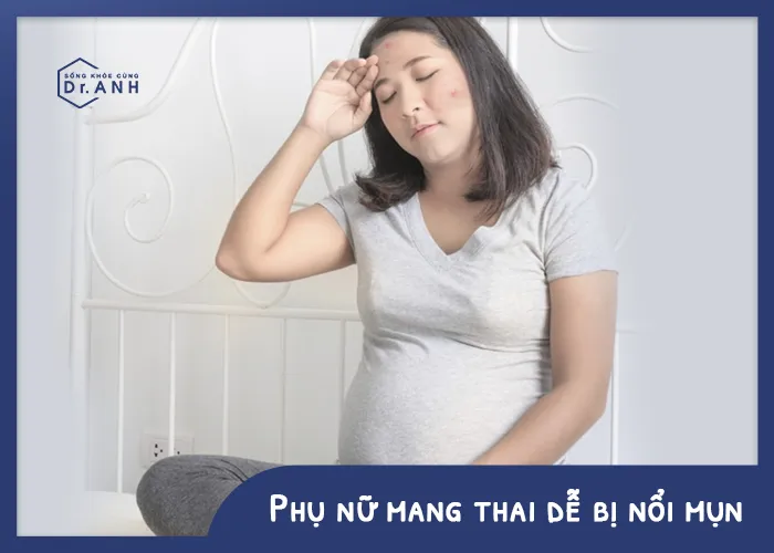 Đối tượng nào dễ bị mụn “tấn công”? - Ảnh 2.