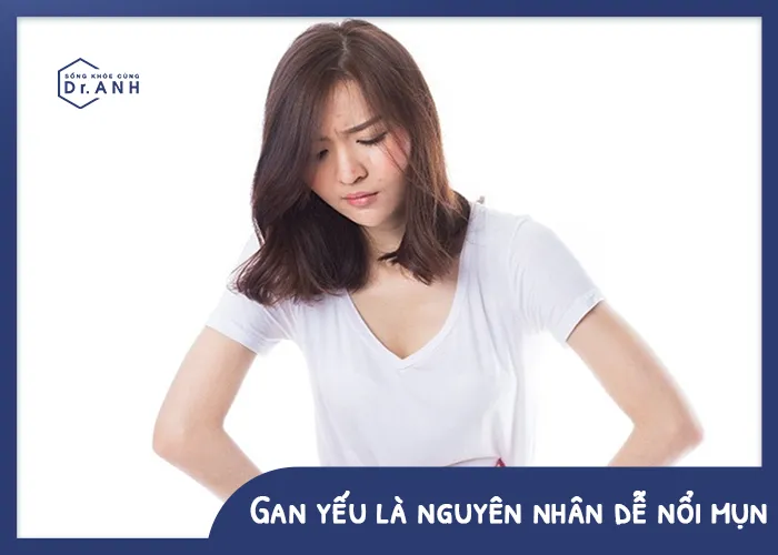 Đối tượng nào dễ bị mụn “tấn công”? - Ảnh 3.