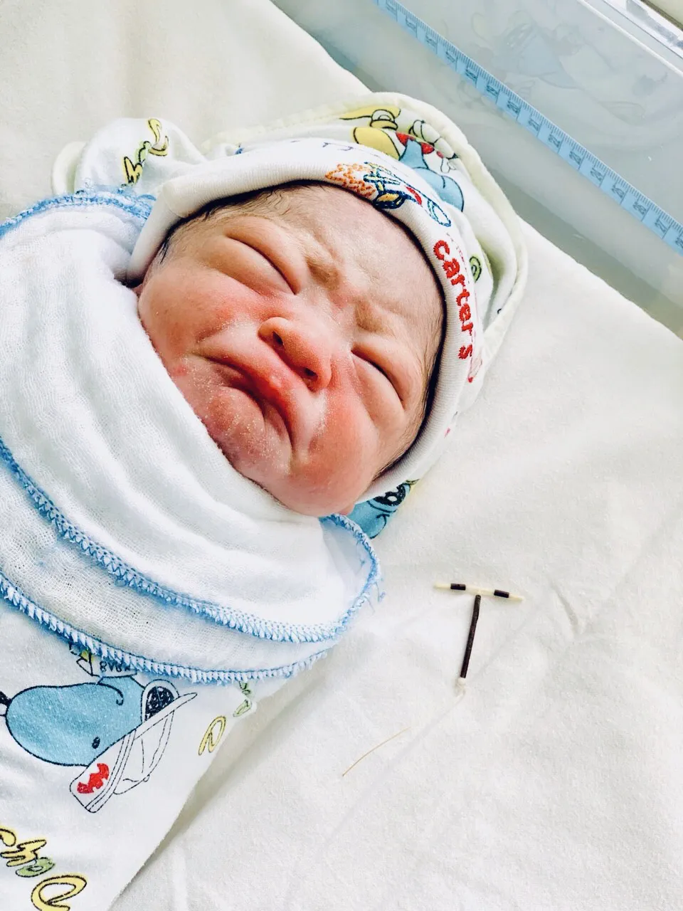 Hy hữu: Mẹ đặt vòng tránh thai, con vẫn nhất định ra đời, mang theo luôn vòng tránh thai trả mẹ - Ảnh 2. Hy hữu: Mẹ đặt vòng tránh thai, con vẫn nhất định ra đời, mang theo luôn vòng tránh thai trả mẹ - Ảnh 2.