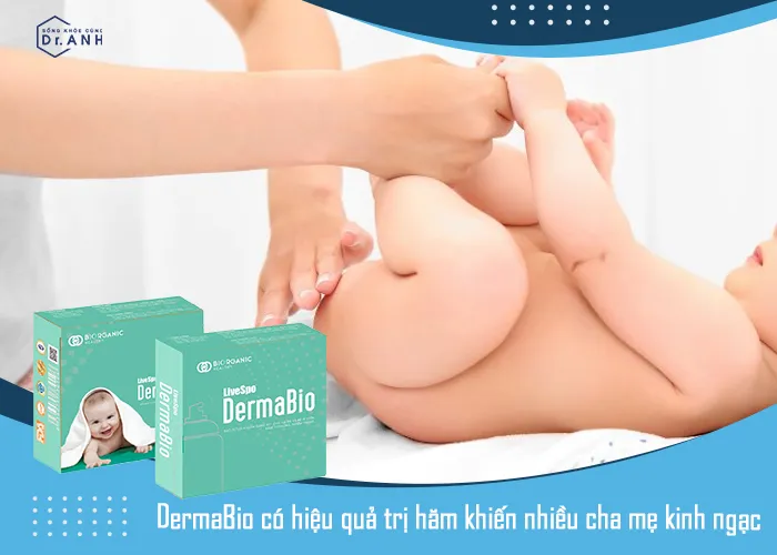 Bỏ túi mẹo trị hăm siêu đơn giản dành cho bé yêu - Ảnh 2.