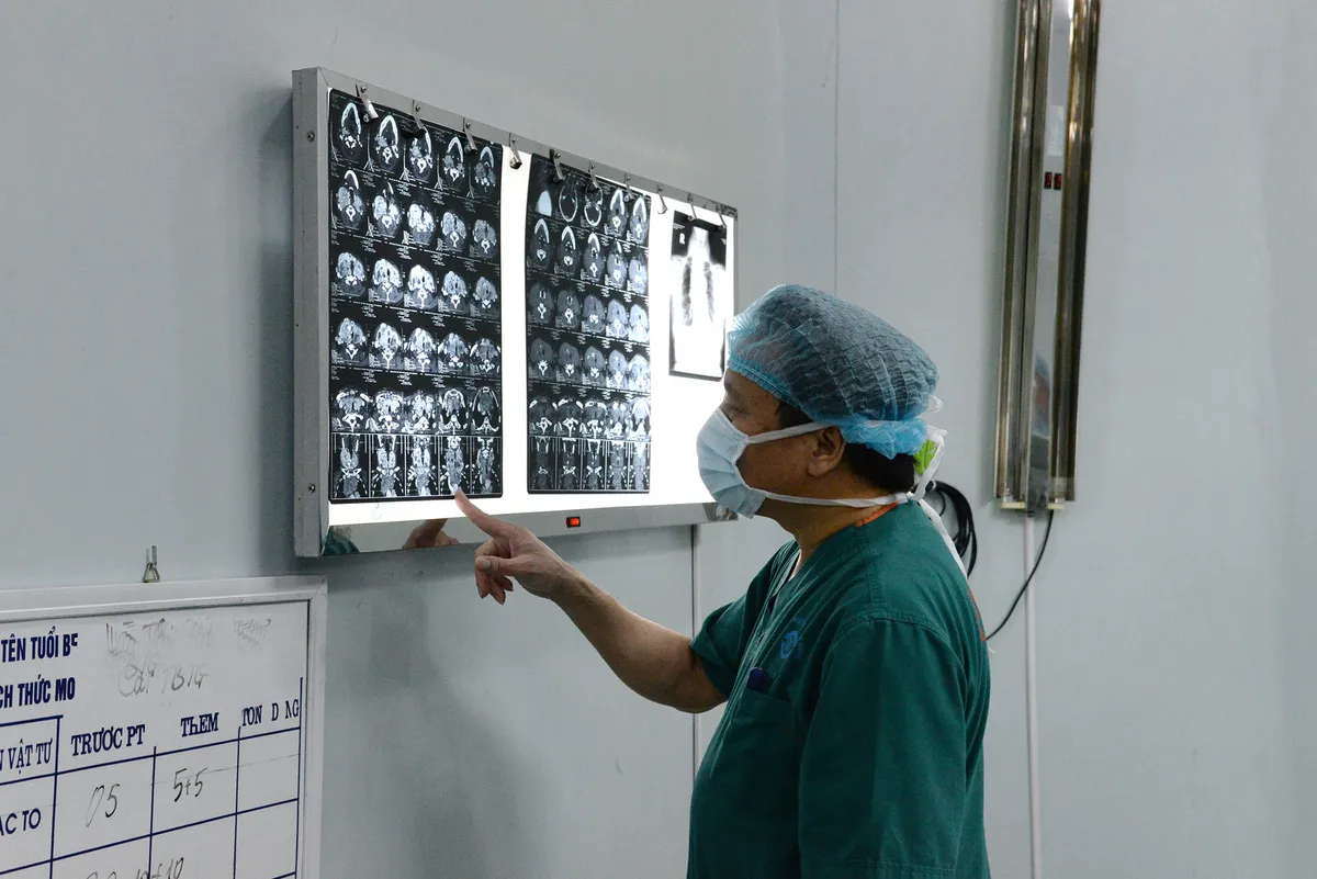 Cắt bướu giáp khổng lồ thòng trung thất 30 năm cho người phụ nữ ở Điện Biên - Ảnh 1. Cắt bướu giáp khổng lồ thòng trung thất 30 năm cho người phụ nữ ở Điện Biên - Ảnh 1.