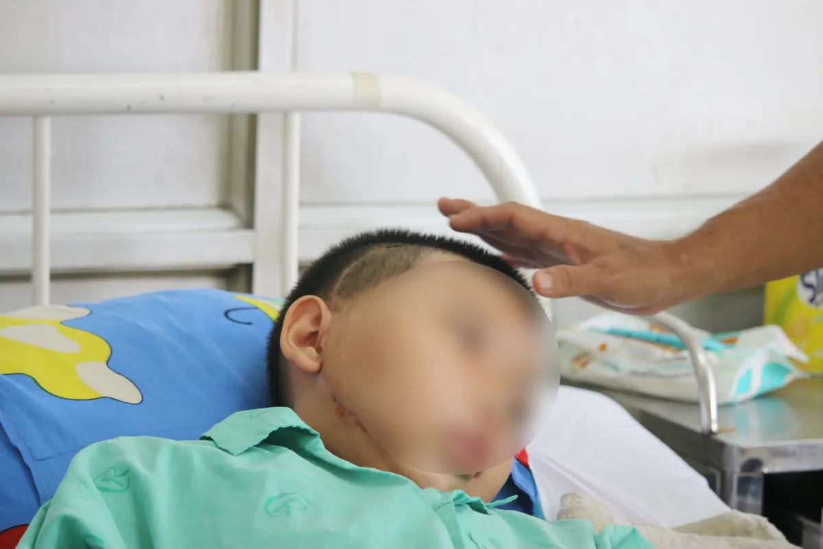 Cắt bỏ khối u xơ vòm mũi họng khổng lồ cho bé trai 13 tuổi - Ảnh 1. Cắt bỏ khối u xơ vòm mũi họng khổng lồ cho bé trai 13 tuổi - Ảnh 1.