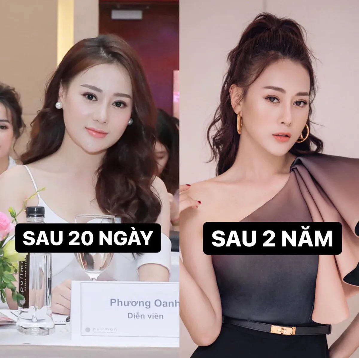 Phương Oanh giật mình nhìn lại ảnh chưa phẫu thuật thẩm mỹ - Ảnh 1. Phương Oanh giật mình nhìn lại ảnh chưa phẫu thuật thẩm mỹ - Ảnh 1.