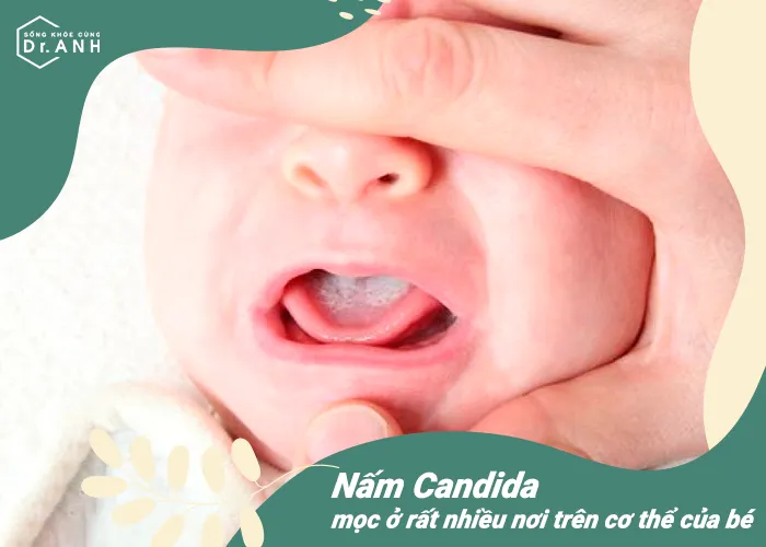 Top 5 nguy&ecirc;n nh&acirc;n h&agrave;ng đầu khiến trẻ sơ sinh bị nổi mẩn đỏ - Ảnh 3.