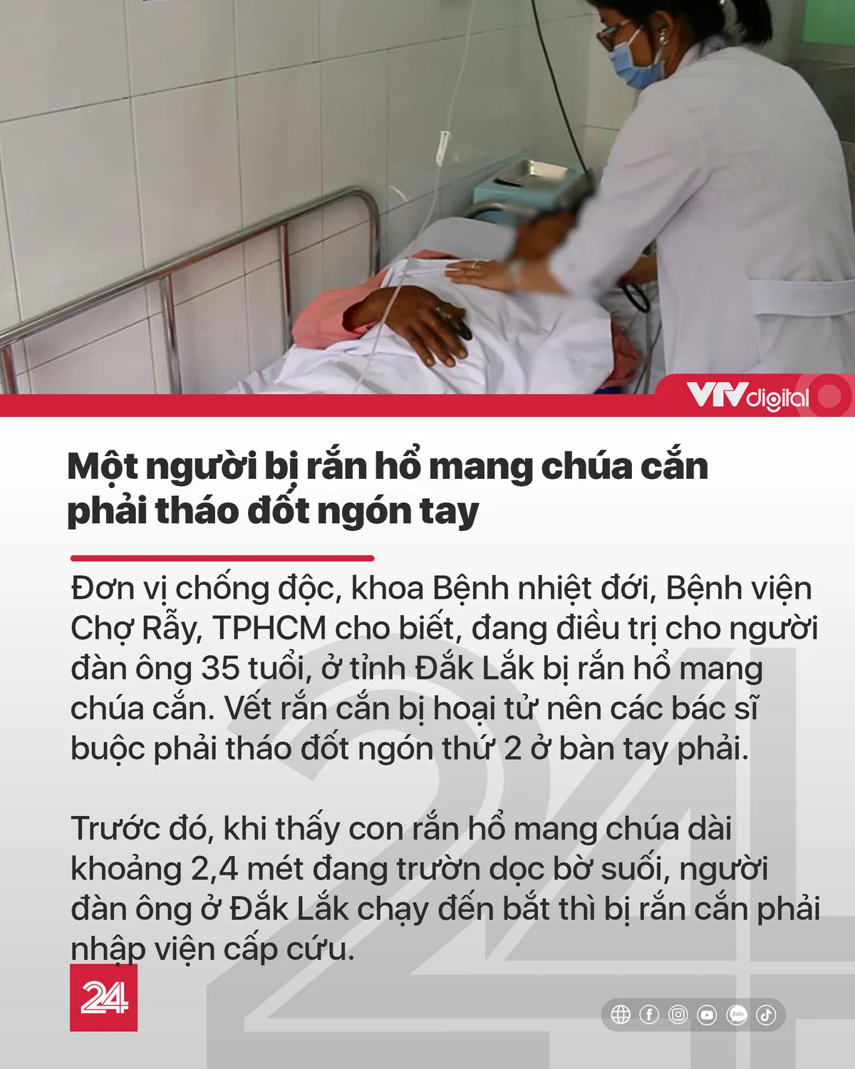 Tin nóng đầu ngày 29/9: Tháo đốt ngón tay vì bị rắn hổ mang chúa cắn - Ảnh 3.