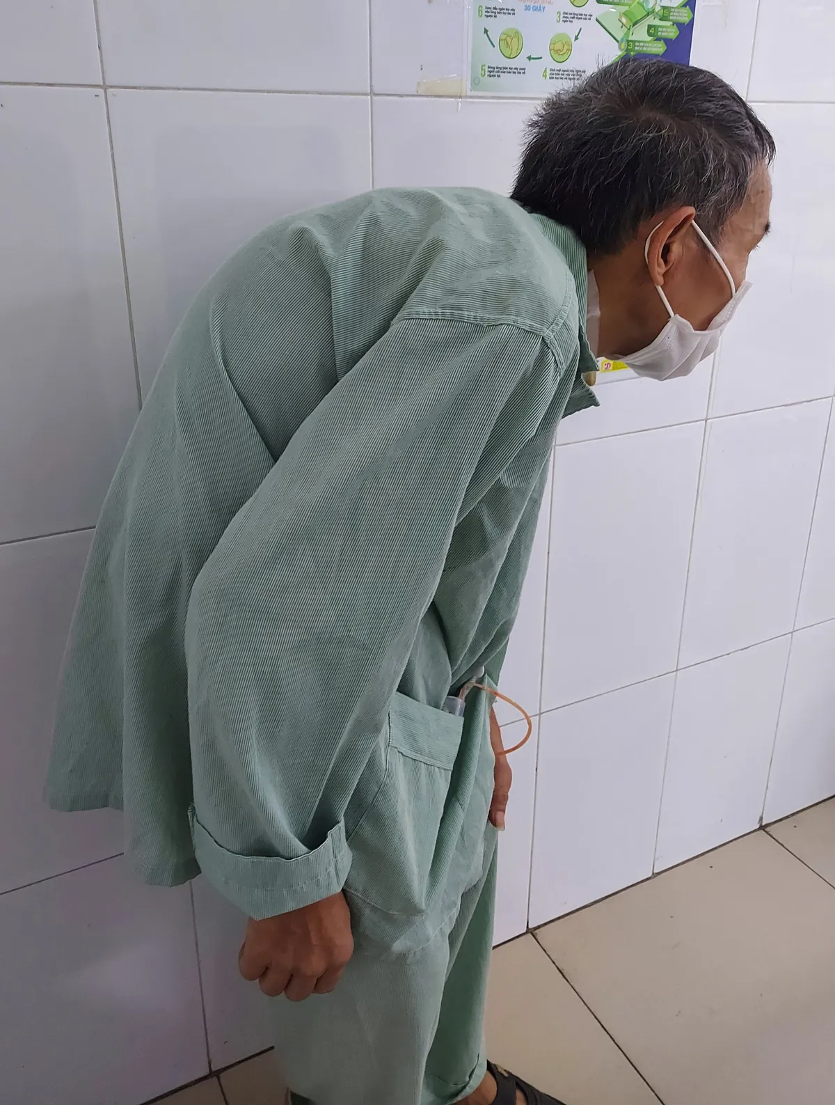 Mổ cắt u trong tư thế đặc biệt cho bệnh nhân bị còng gập lưng, thể trạng suy kiệt - Ảnh 1. Mổ cắt u trong tư thế đặc biệt cho bệnh nhân bị còng gập lưng, thể trạng suy kiệt - Ảnh 1.