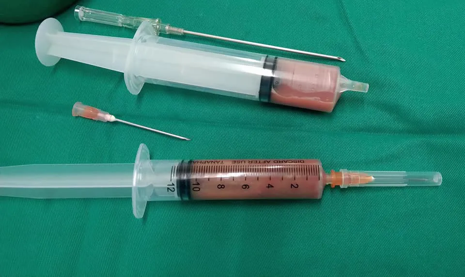 Tin thần y tiêm khớp, cụ ông ở Nghệ An đau đớn nhập viện - Ảnh 3.
