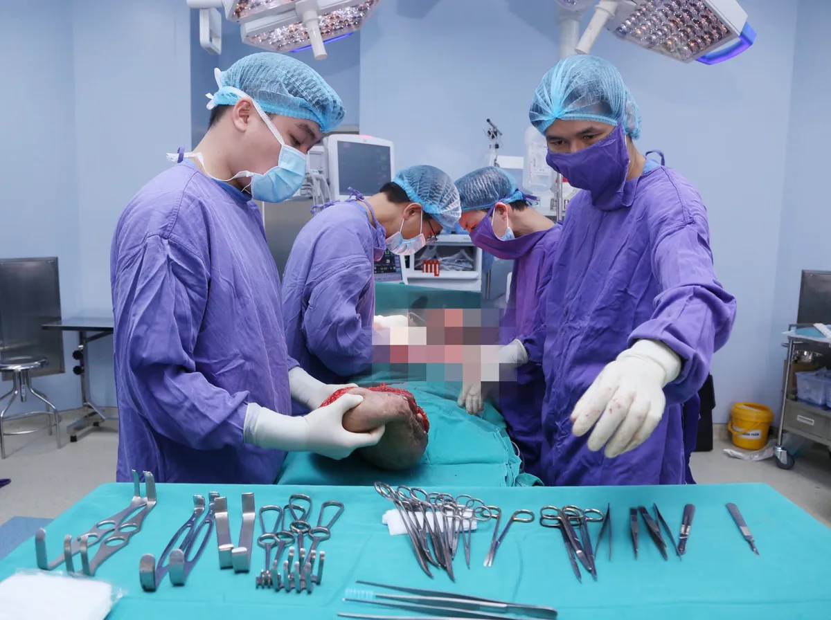 Cứu người phụ nữ gánh trên vai khối u khổng lồ - Ảnh 1. Cứu người phụ nữ gánh trên vai khối u khổng lồ - Ảnh 1.