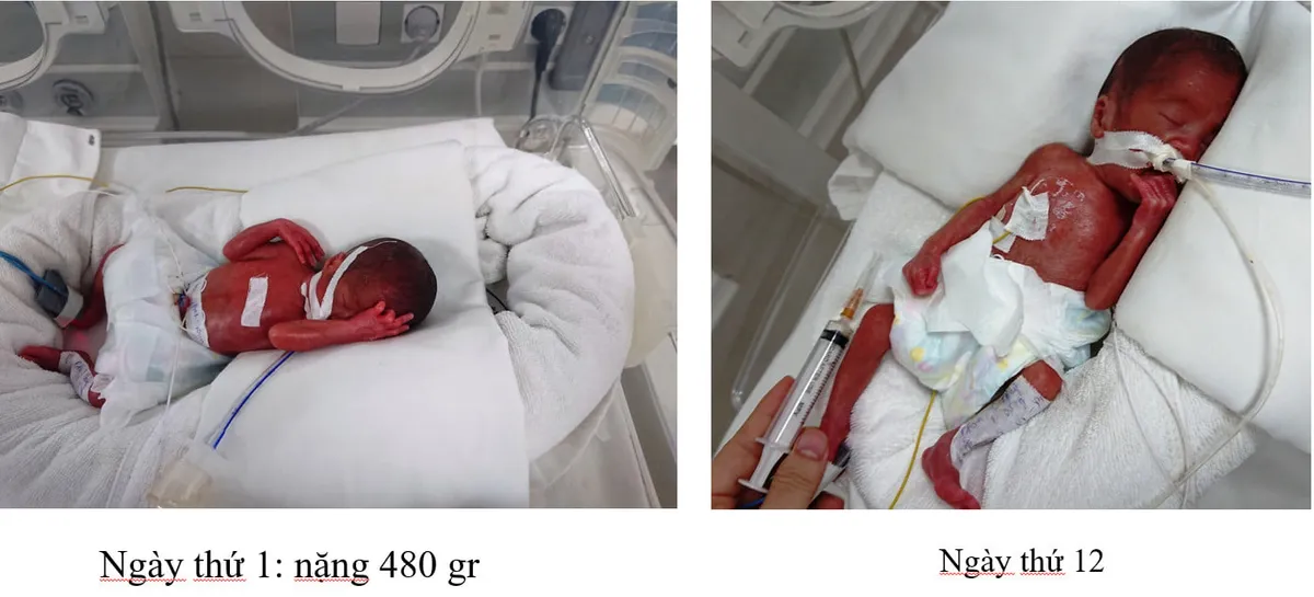 Hội chẩn trực tuyến, kết nối từ xa: Xóa nhòa khoảng cách trong điều trị bệnh nhân nặng - Ảnh 3. Hội chẩn trực tuyến, kết nối từ xa: Xóa nhòa khoảng cách trong điều trị bệnh nhân nặng - Ảnh 3.