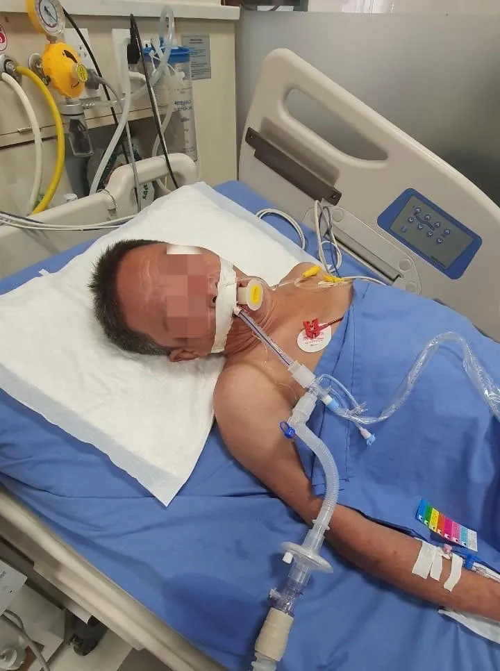Cứu sống bệnh nhân bị rắn hổ mang chúa cắn - Ảnh 1. Cứu sống bệnh nhân bị rắn hổ mang chúa cắn - Ảnh 1.
