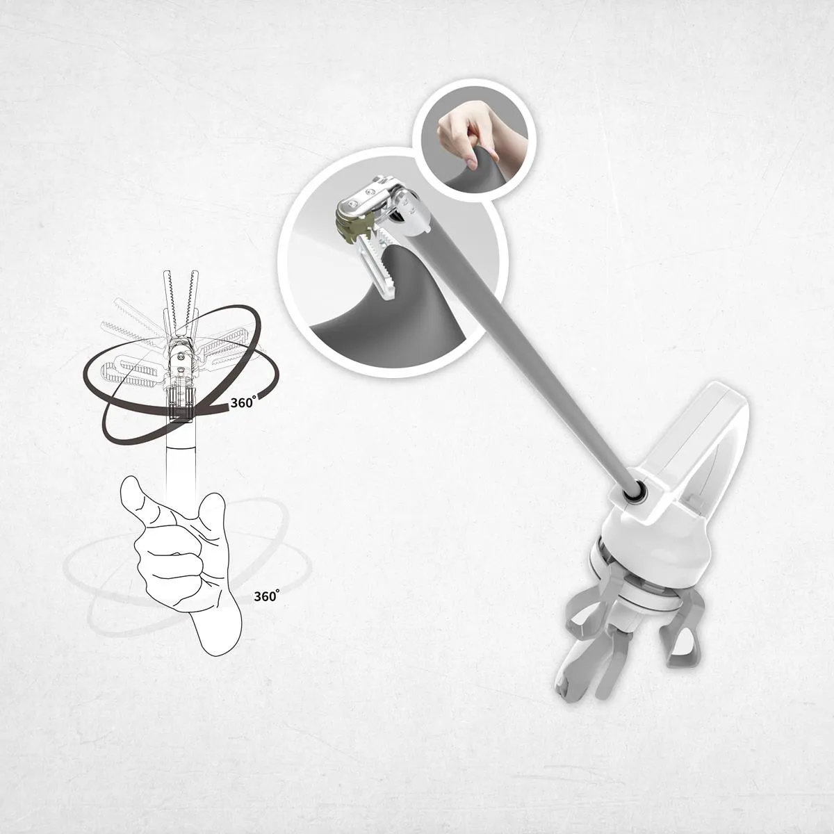 Lần đầu tiên Việt Nam ứng dụng robot cầm tay cơ học vào phẫu thuật nội soi - Ảnh 2. Lần đầu tiên Việt Nam ứng dụng robot cầm tay cơ học vào phẫu thuật nội soi - Ảnh 2.