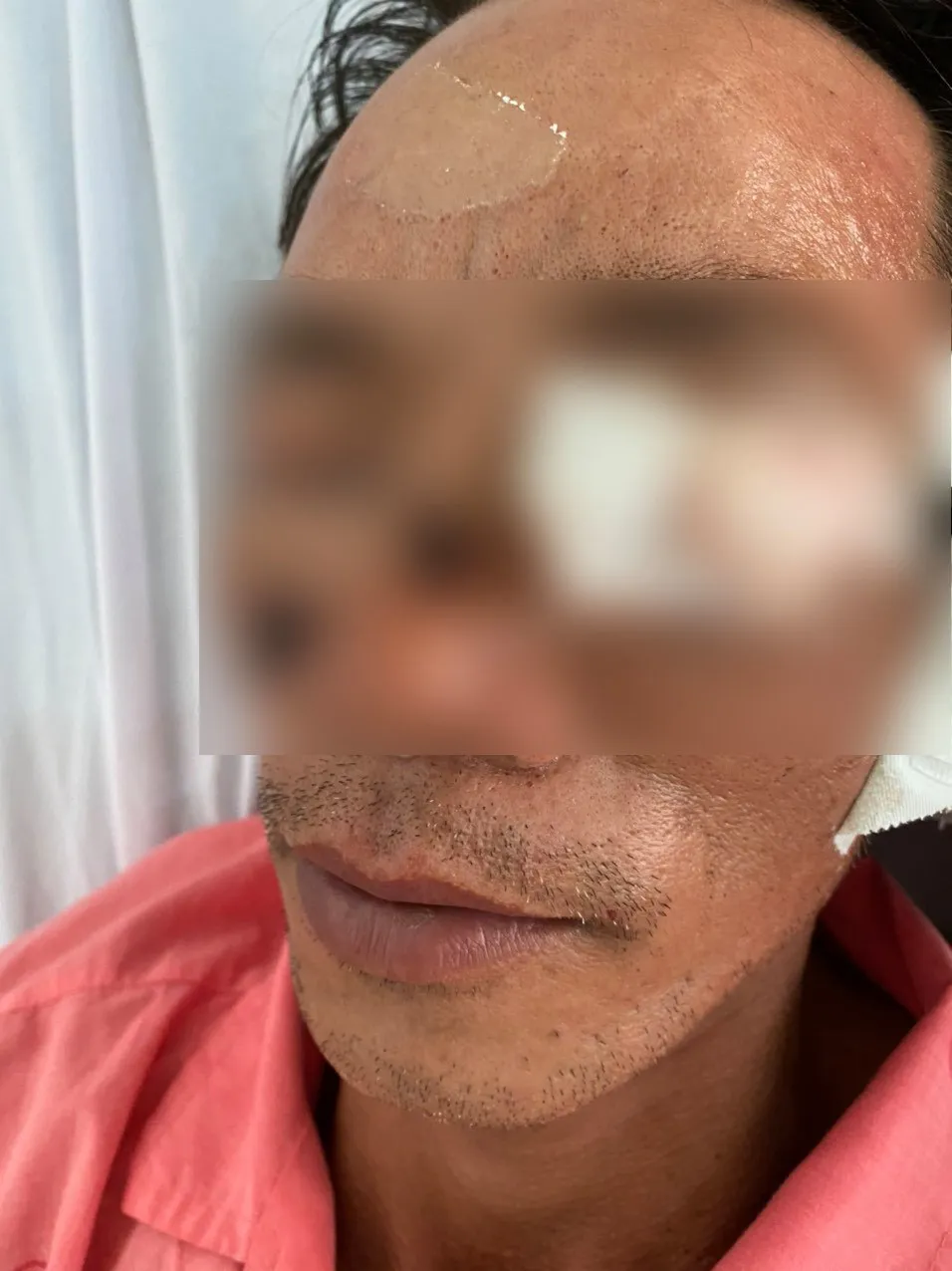 Nhiều tai nạn thương tâm do pháo nổ dịp Tết - Ảnh 1. Nhiều tai nạn thương tâm do pháo nổ dịp Tết - Ảnh 1.