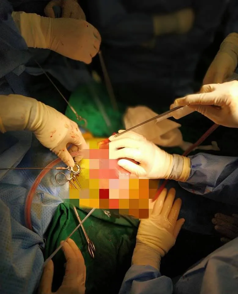 Đùa nghịch làm vỡ cốc thủy tinh, bé 16 tháng bị mảnh vỡ làm thủng bụng - Ảnh 1. Đùa nghịch làm vỡ cốc thủy tinh, bé 16 tháng bị mảnh vỡ làm thủng bụng - Ảnh 1.