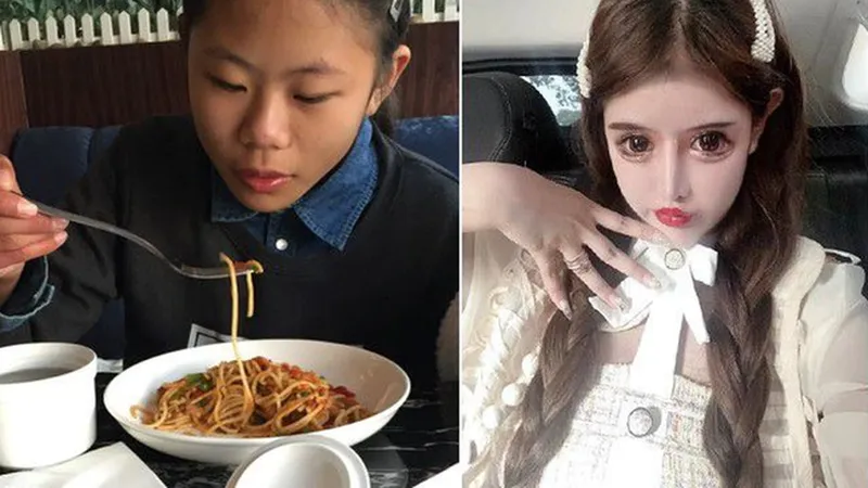 Cô gái 16 tuổi nghiện phẫu thuật thẩm mỹ nhất Trung Quốc là ai? - Ảnh 3. Cô gái 16 tuổi nghiện phẫu thuật thẩm mỹ nhất Trung Quốc là ai? - Ảnh 3.