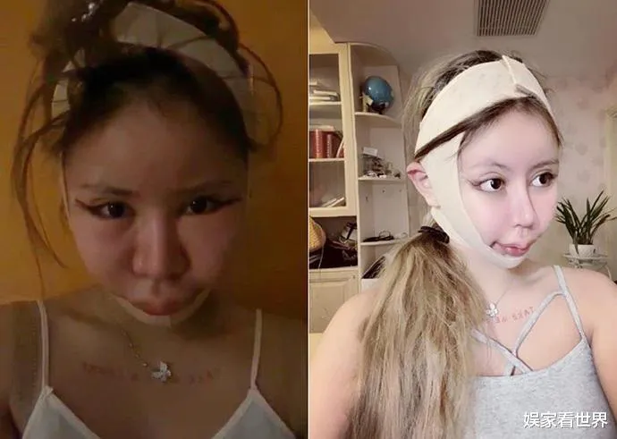Cô gái 16 tuổi nghiện phẫu thuật thẩm mỹ nhất Trung Quốc là ai? - Ảnh 1. Cô gái 16 tuổi nghiện phẫu thuật thẩm mỹ nhất Trung Quốc là ai? - Ảnh 1.