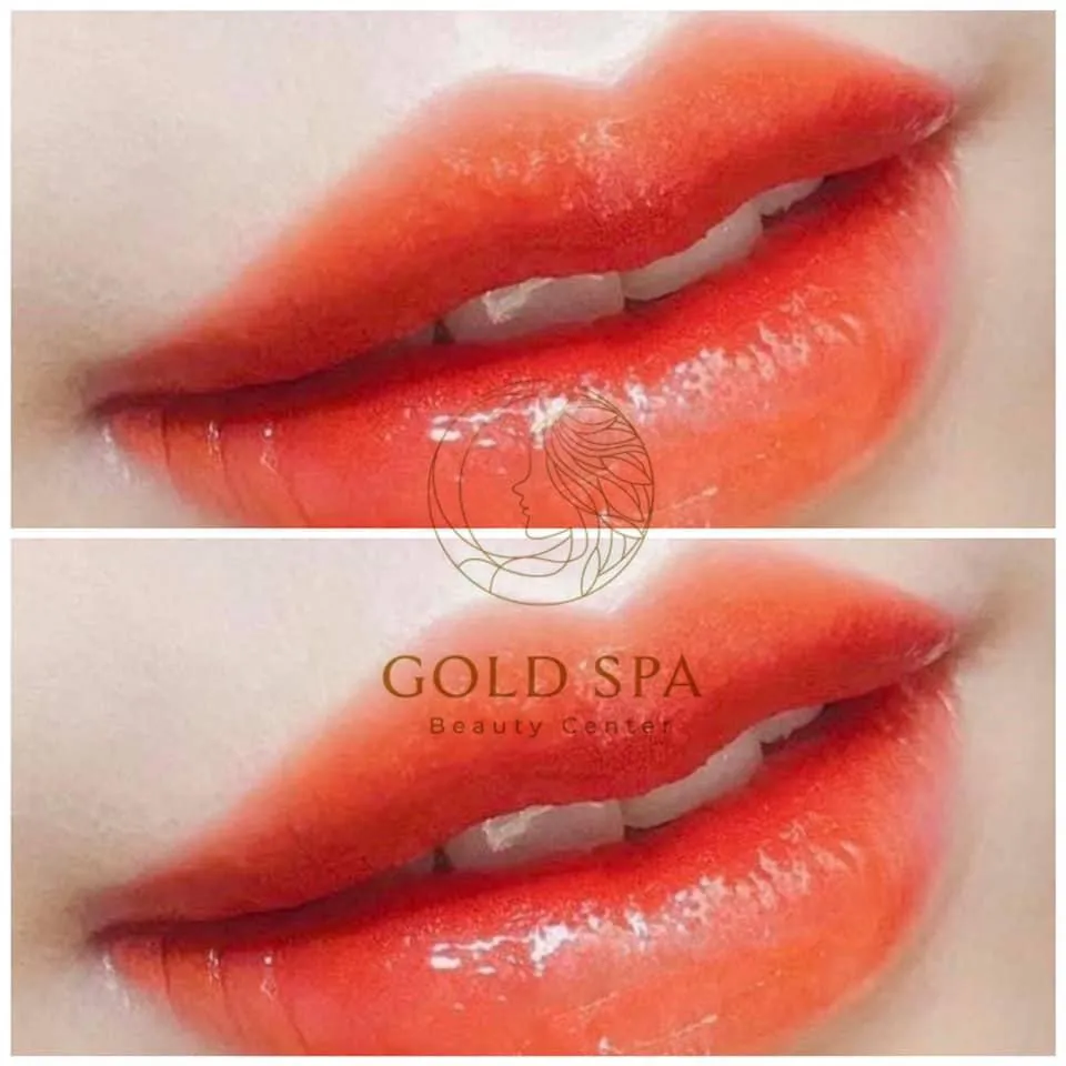 Thẩm mỹ viện Gold Spa Cà Mau - Địa điểm làm đẹp tin cậy cho chị em ở Cà Mau - Ảnh 1. Thẩm mỹ viện Gold Spa Cà Mau - Địa điểm làm đẹp tin cậy cho chị em ở Cà Mau - Ảnh 1.