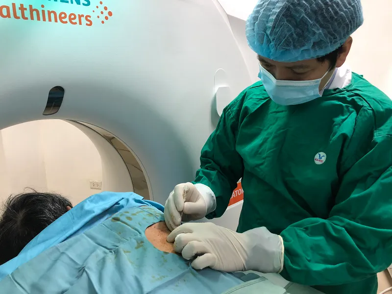 Bệnh nhân rước họa từ thói quen liên tục trong 40 năm - Ảnh 2. Bệnh nhân rước họa từ thói quen liên tục trong 40 năm - Ảnh 2.