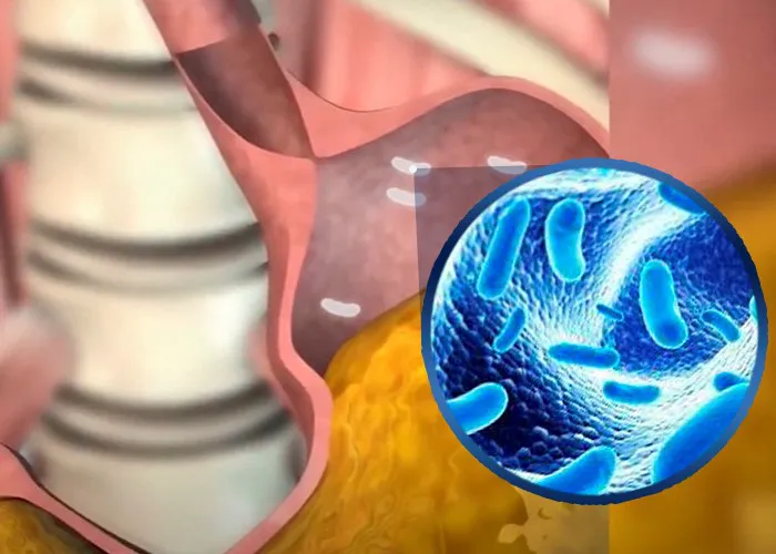 Chuyên gia nói gì về LiveSpo COLON – Bào tử lợi khuẩn cho người viêm đại tràng - Ảnh 3. Chuyên gia nói gì về LiveSpo COLON – Bào tử lợi khuẩn cho người viêm đại tràng - Ảnh 3.